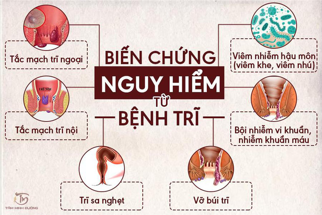 Benh Tri La Gi Nguyen Nhan Trieu Chung Va Cach Dieu Tri Hieu Qua 333